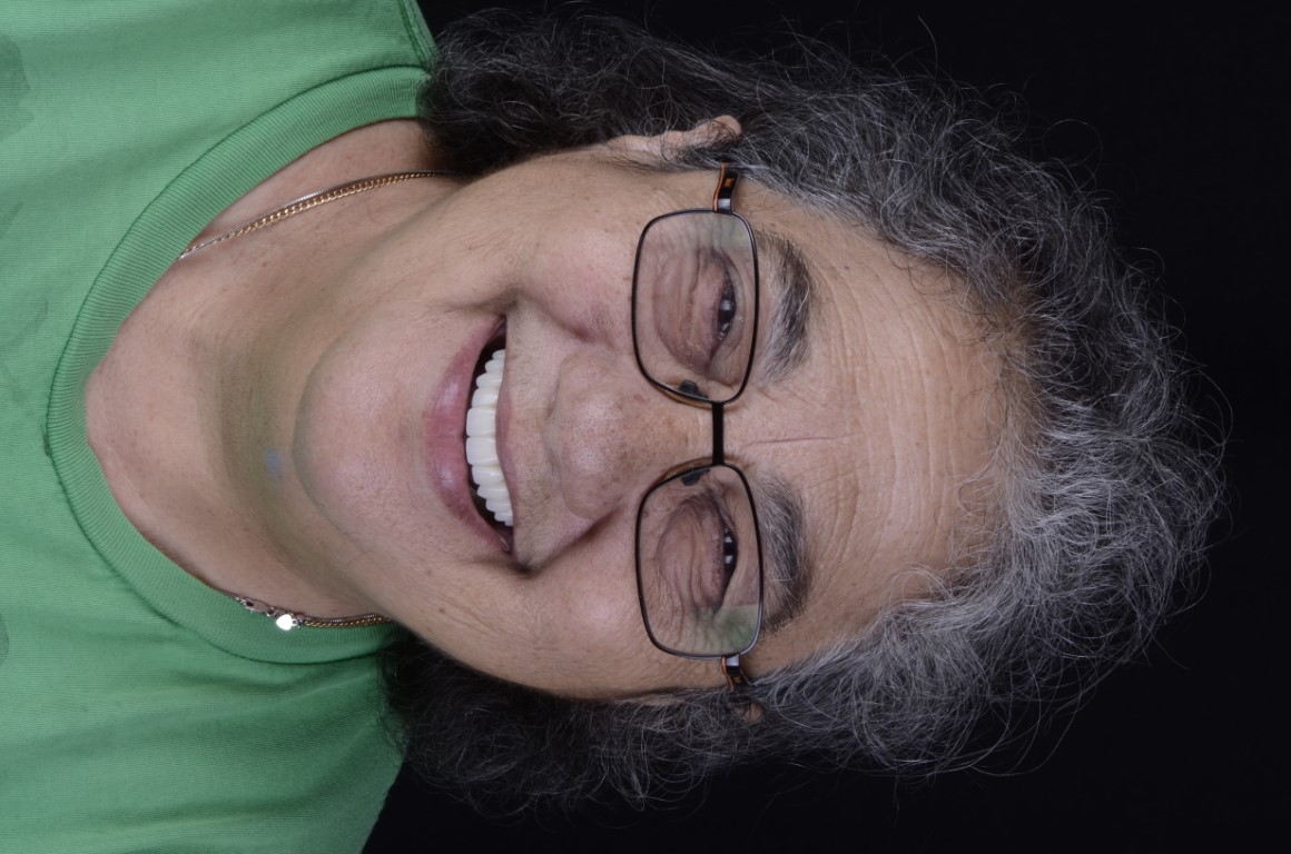 Patient Beautiful Smiles Image