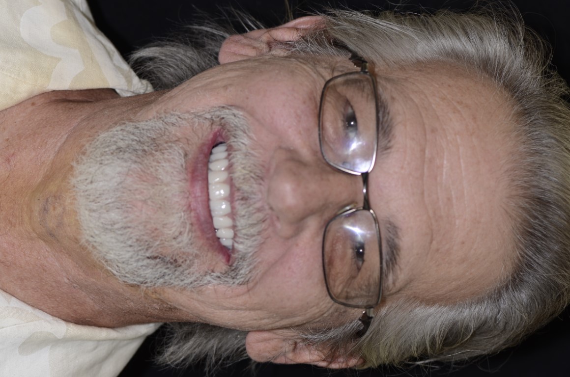 Patient Beautiful Smiles Image