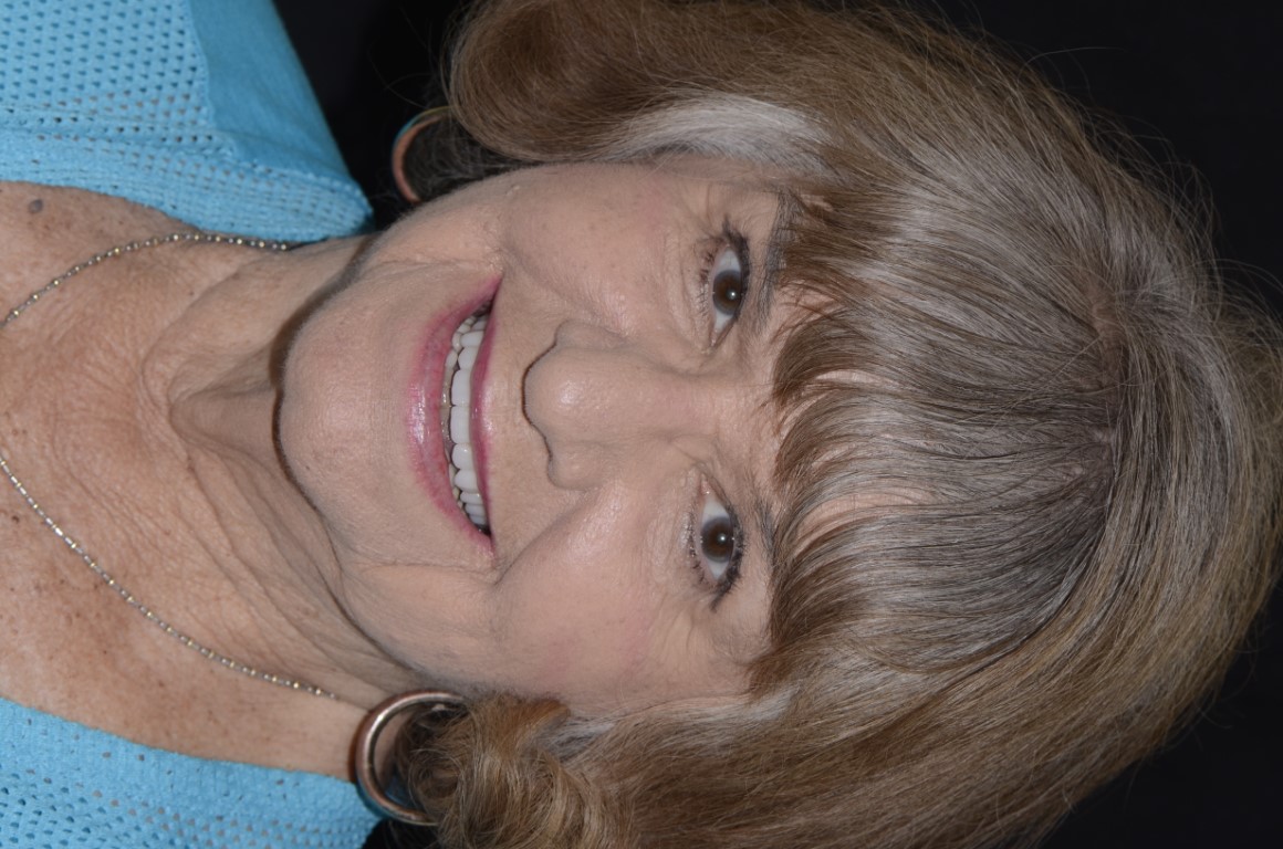 Patient Beautiful Smiles Image