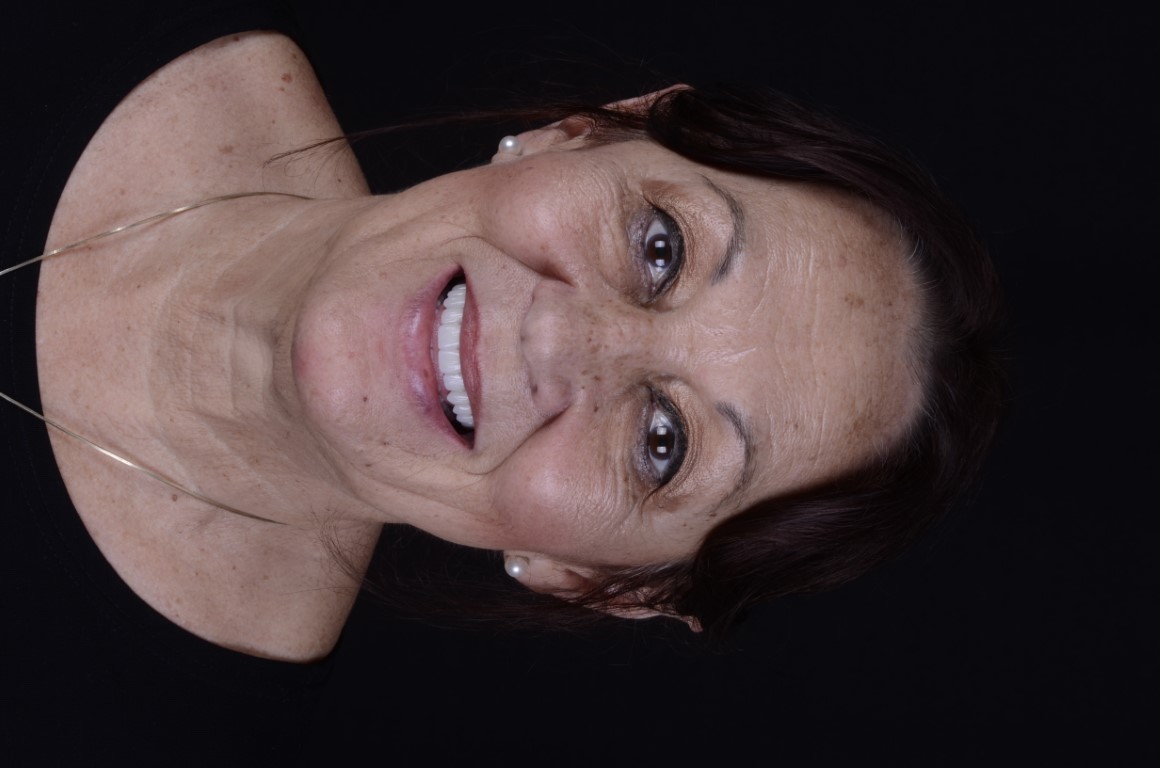 Patient Beautiful Smiles Image