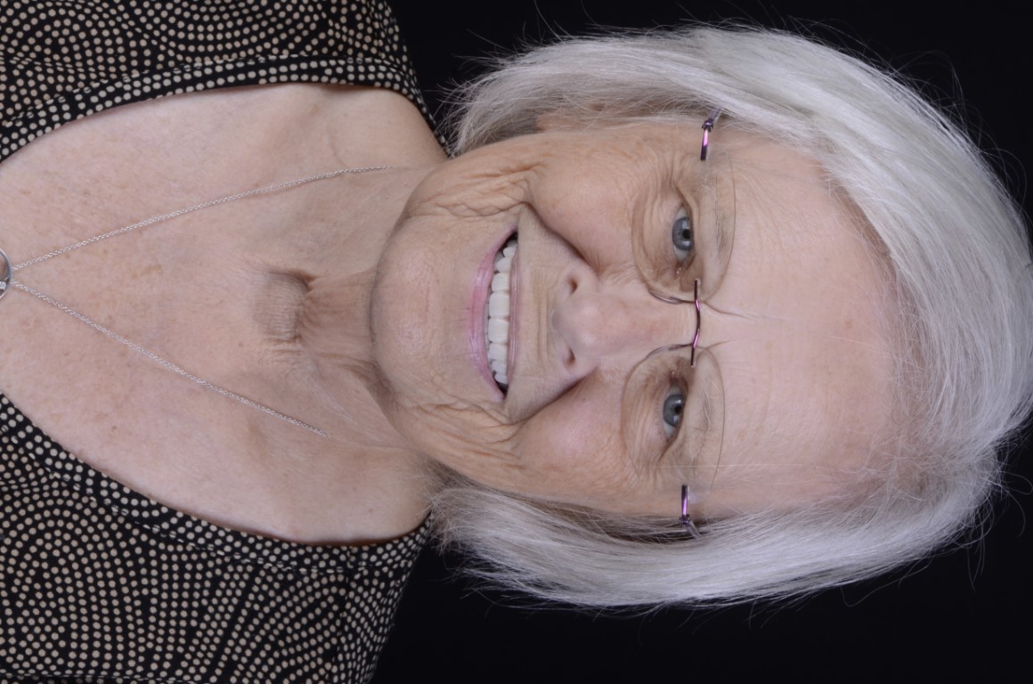 Patient Beautiful Smiles Image