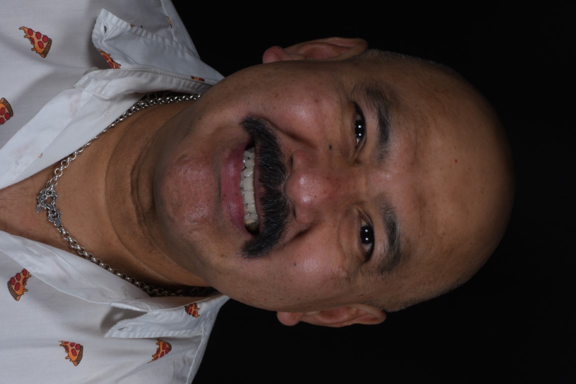 Patient Beautiful Smiles Image