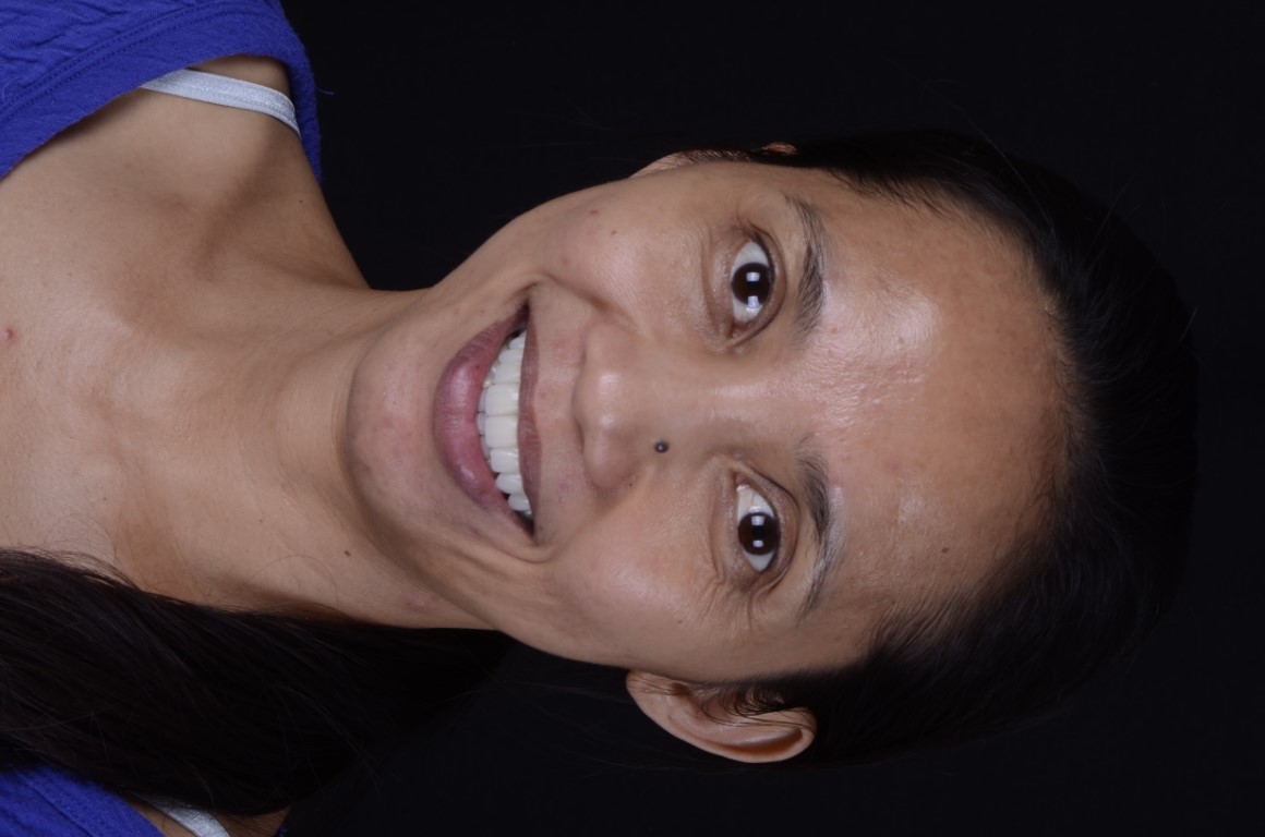 Patient Beautiful Smiles Image