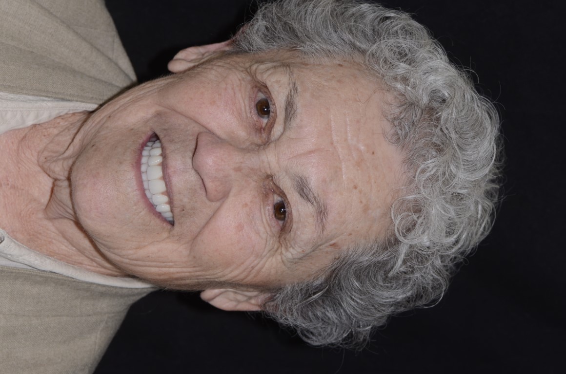 Patient Beautiful Smiles Image