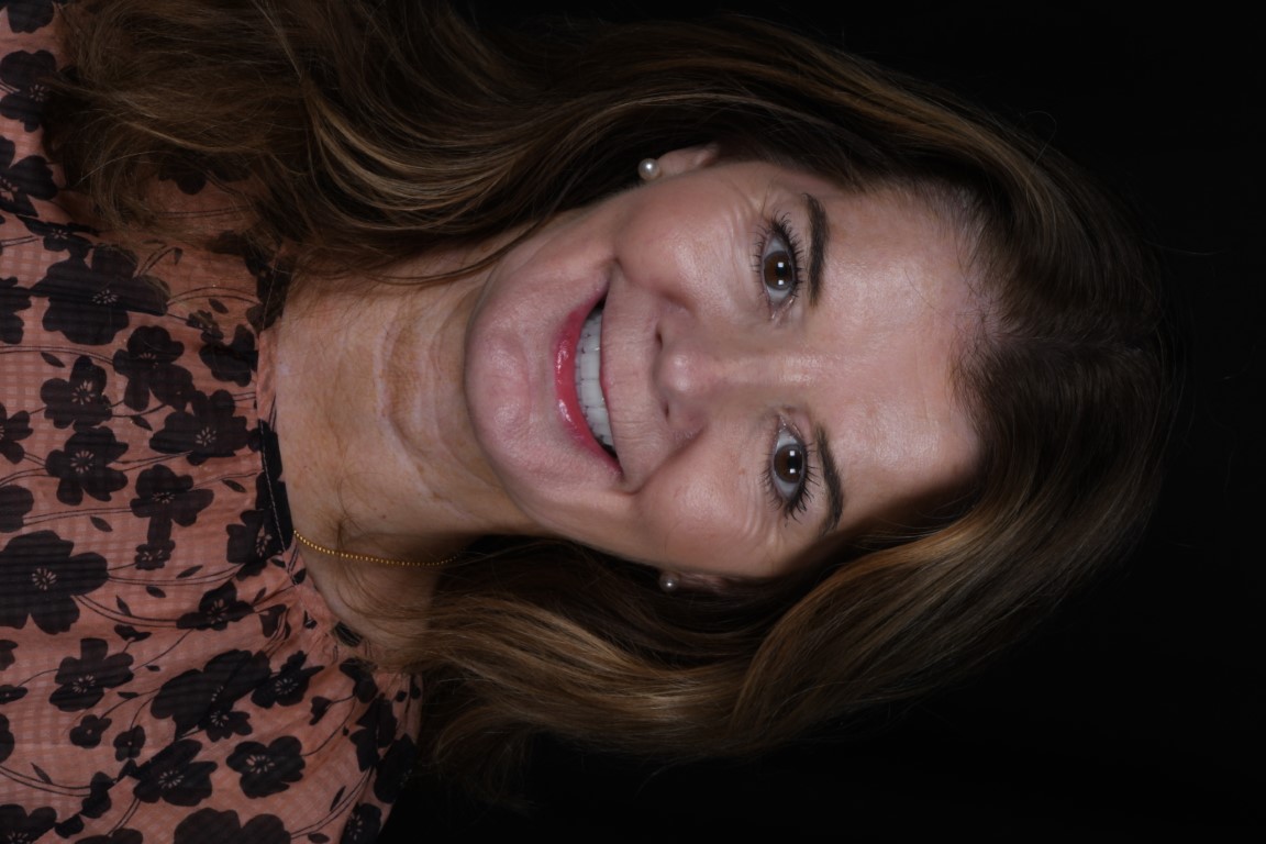 Patient Beautiful Smiles Image