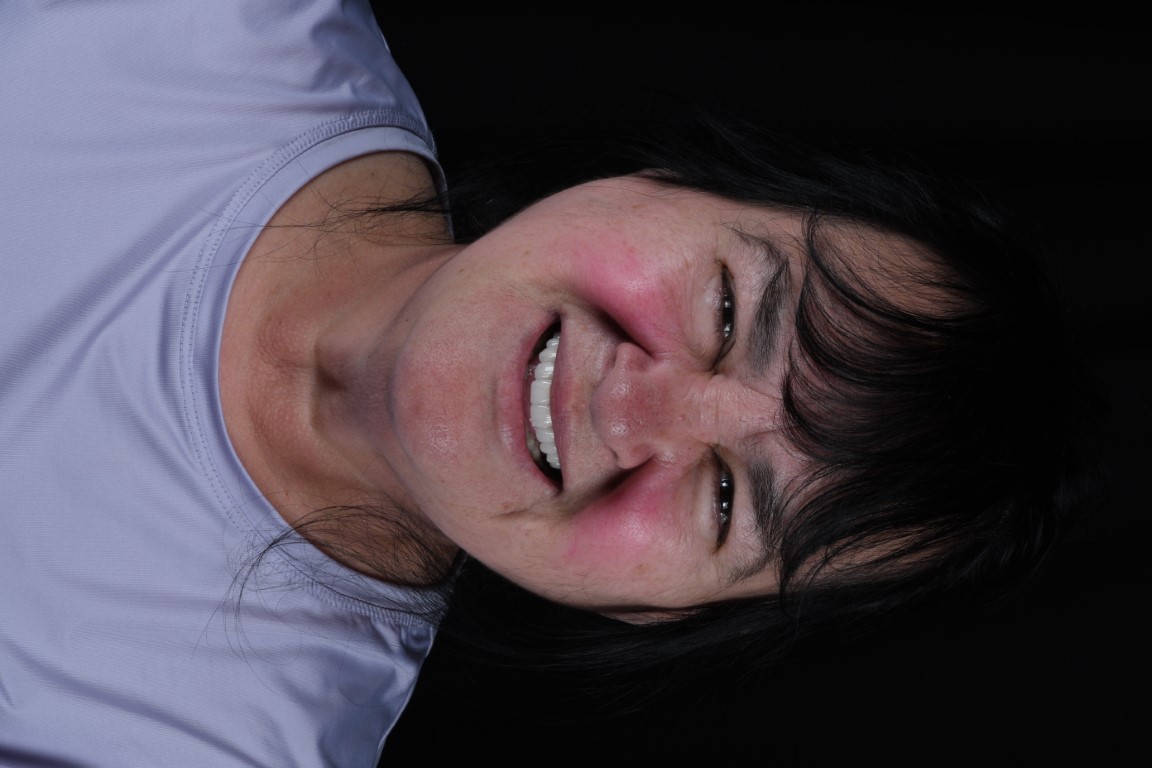 Patient Beautiful Smiles Image