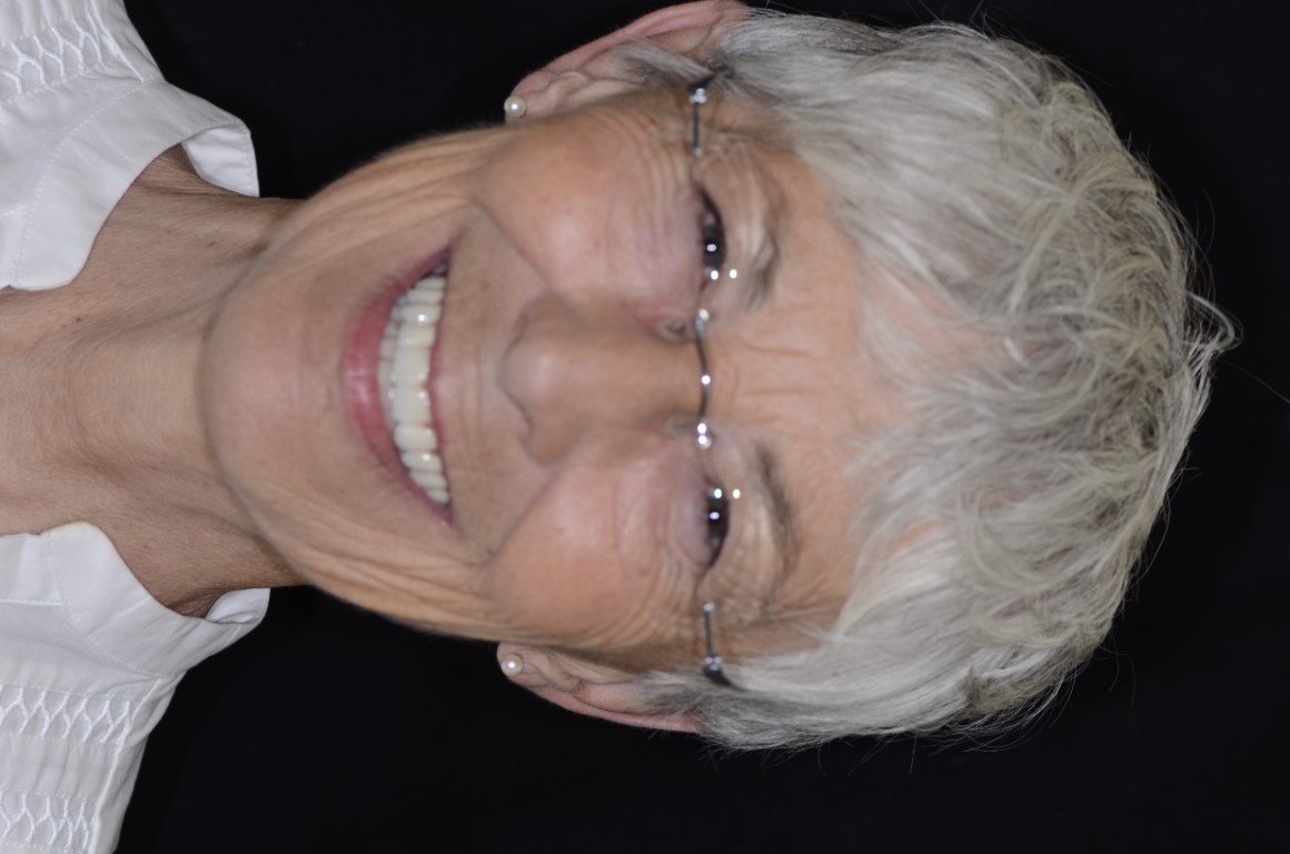 Patient Beautiful Smiles Image