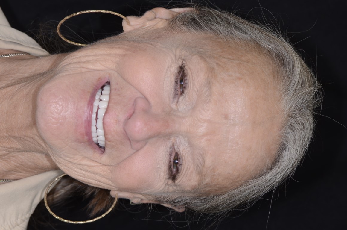 Patient Beautiful Smiles Image