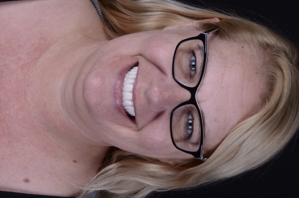 Patient Beautiful Smiles Image