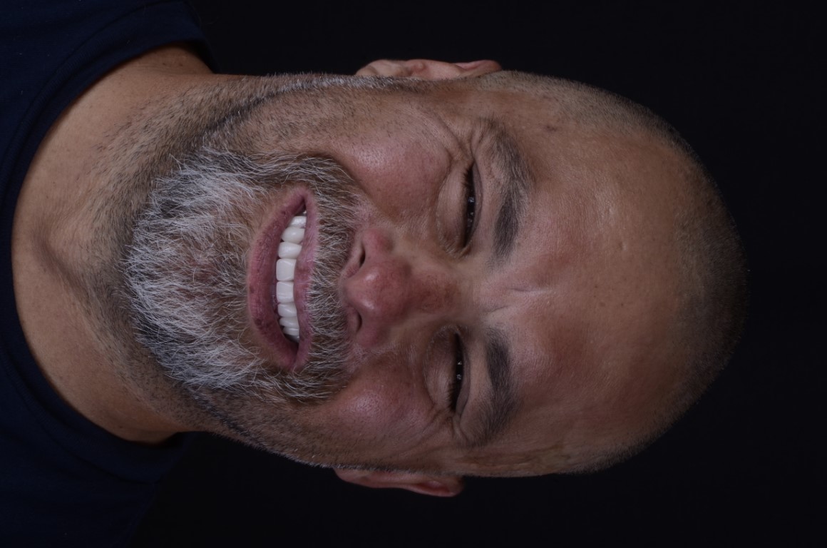 Patient Beautiful Smiles Image