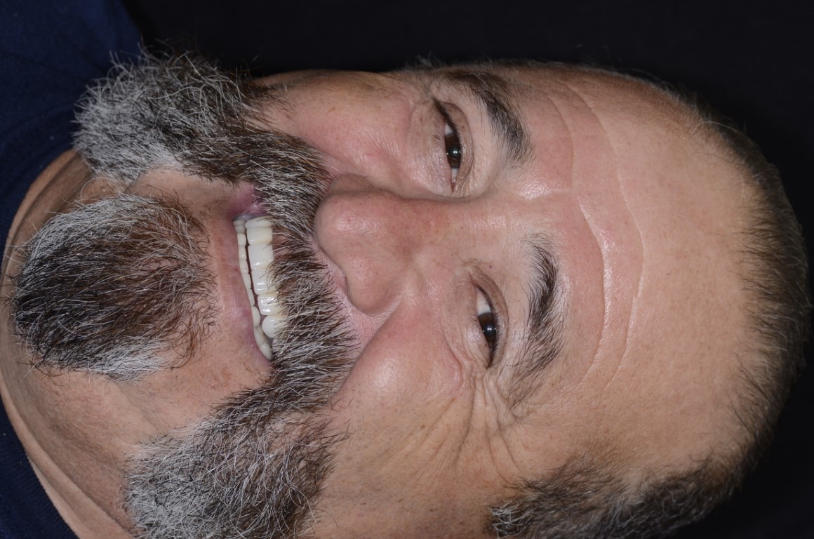 Patient Beautiful Smiles Image