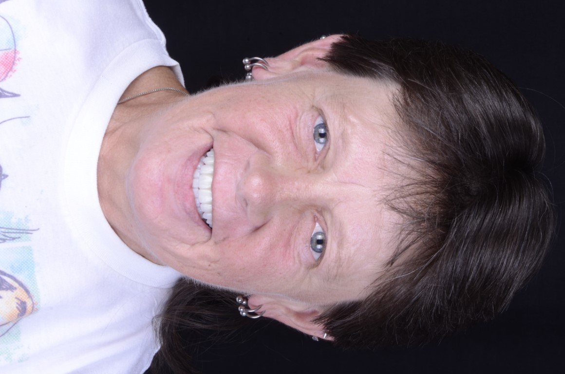 Patient Beautiful Smiles Image