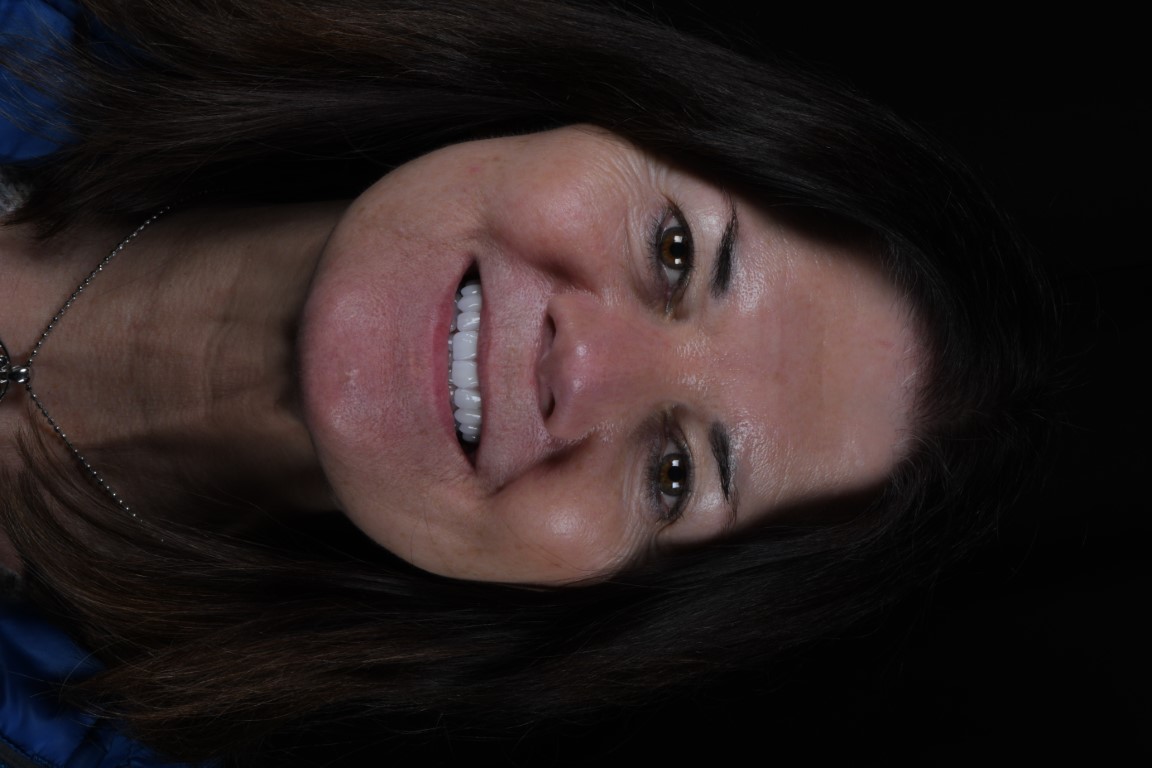 Patient Beautiful Smiles Image