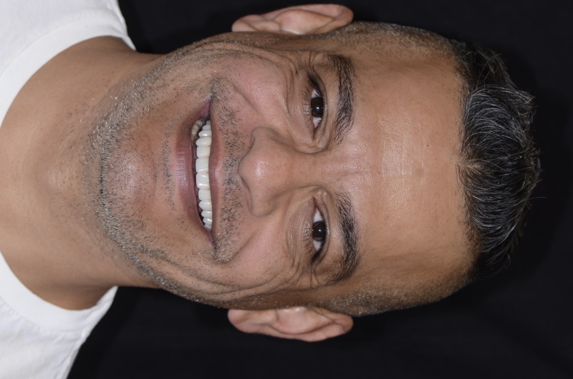 Patient Beautiful Smiles Image