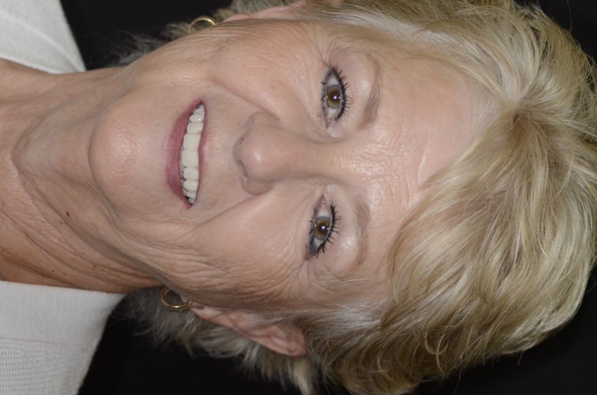 Patient Beautiful Smiles Image