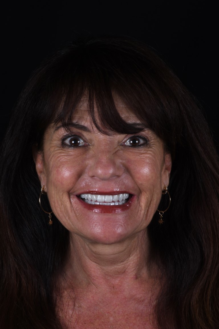 Patient Beautiful Smiles Image