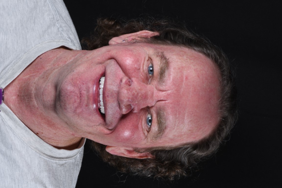 Patient Beautiful Smiles Image