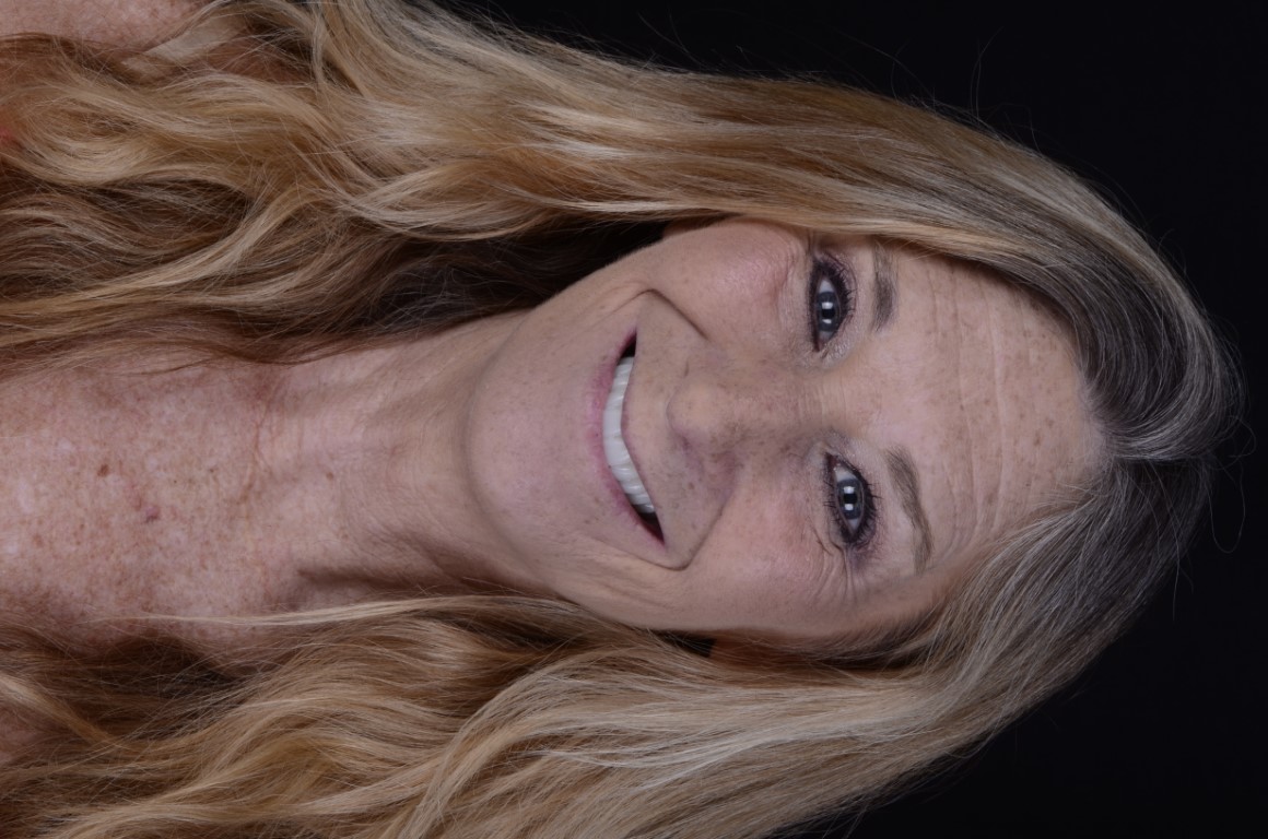 Patient Beautiful Smiles Image