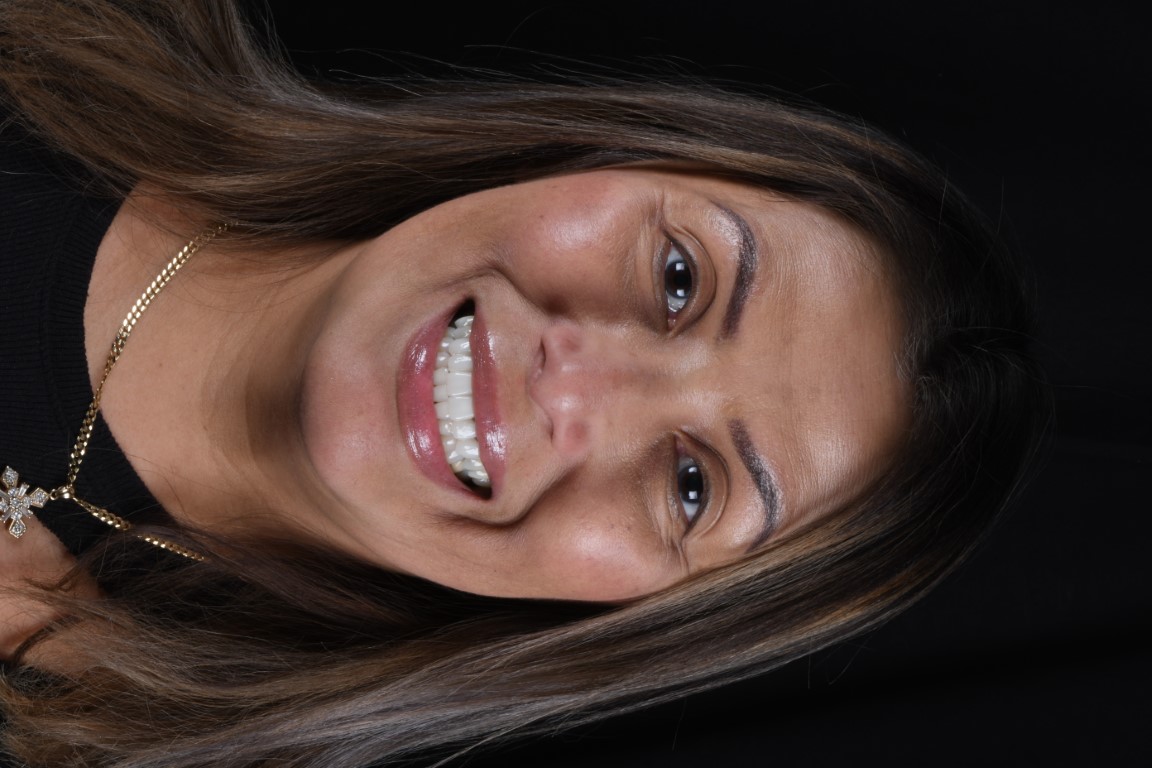 Patient Beautiful Smiles Image