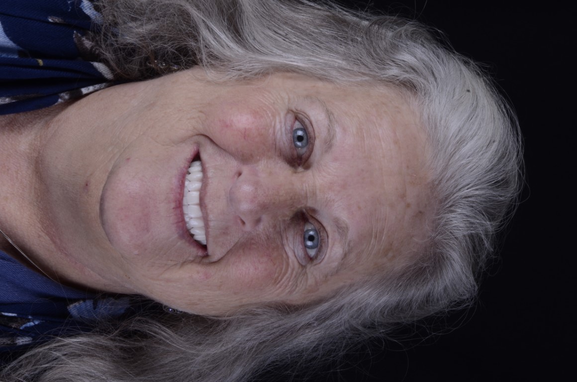 Patient Beautiful Smiles Image