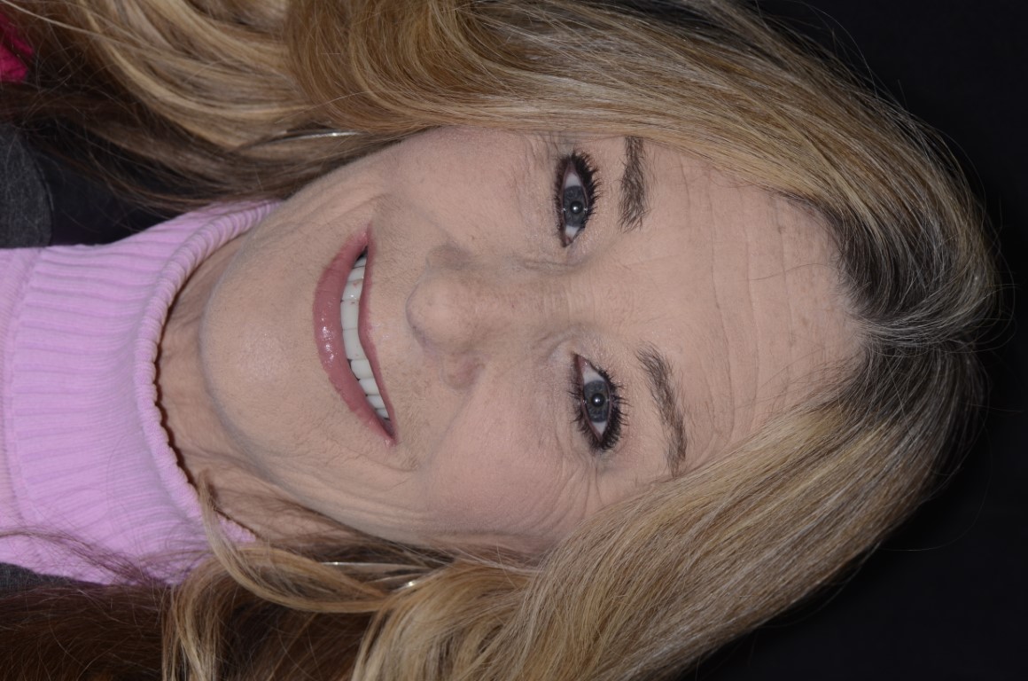 Patient Beautiful Smiles Image