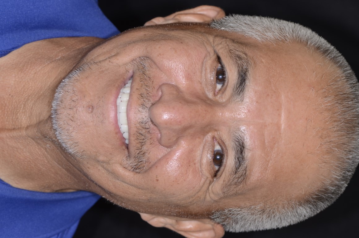 Patient Beautiful Smiles Image