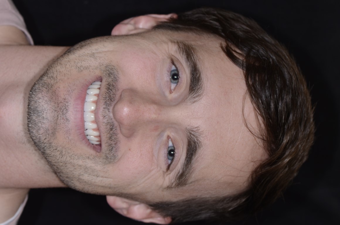 Patient Beautiful Smiles Image