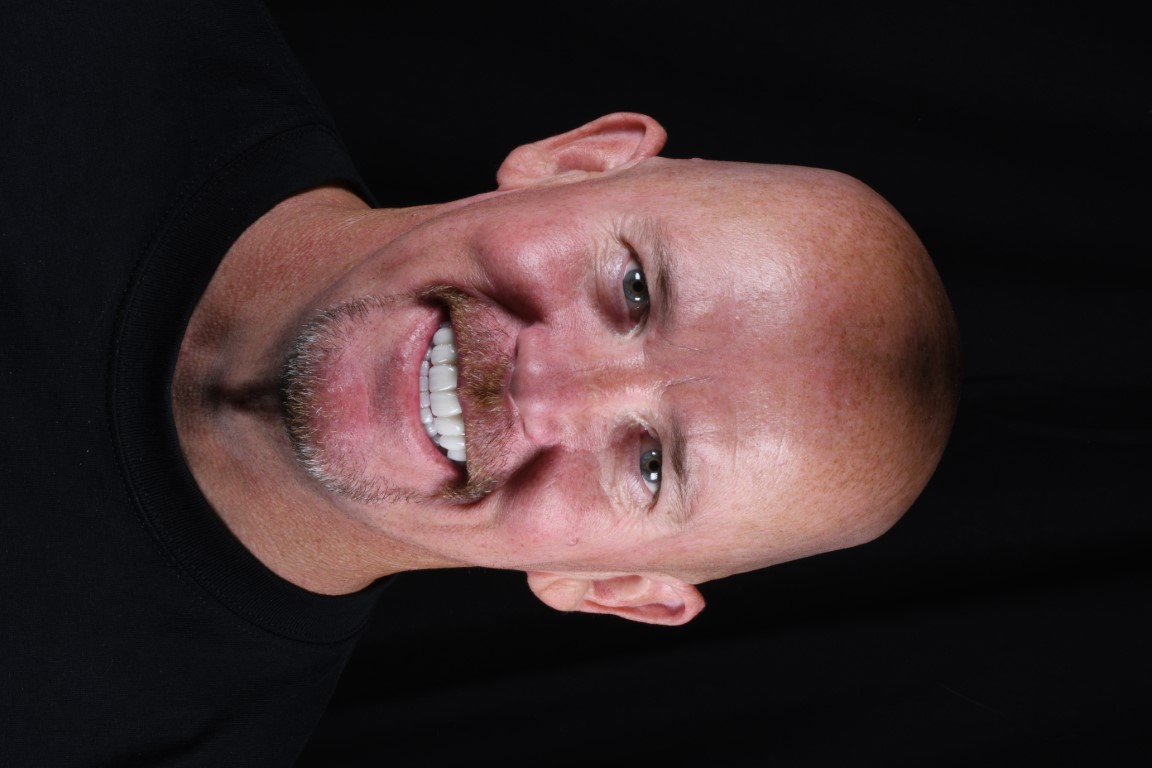 Patient Beautiful Smiles Image