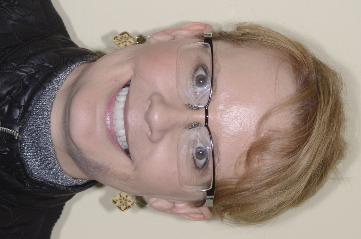 Patient Beautiful Smiles Image