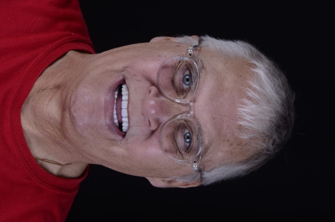 Patient Beautiful Smiles Image