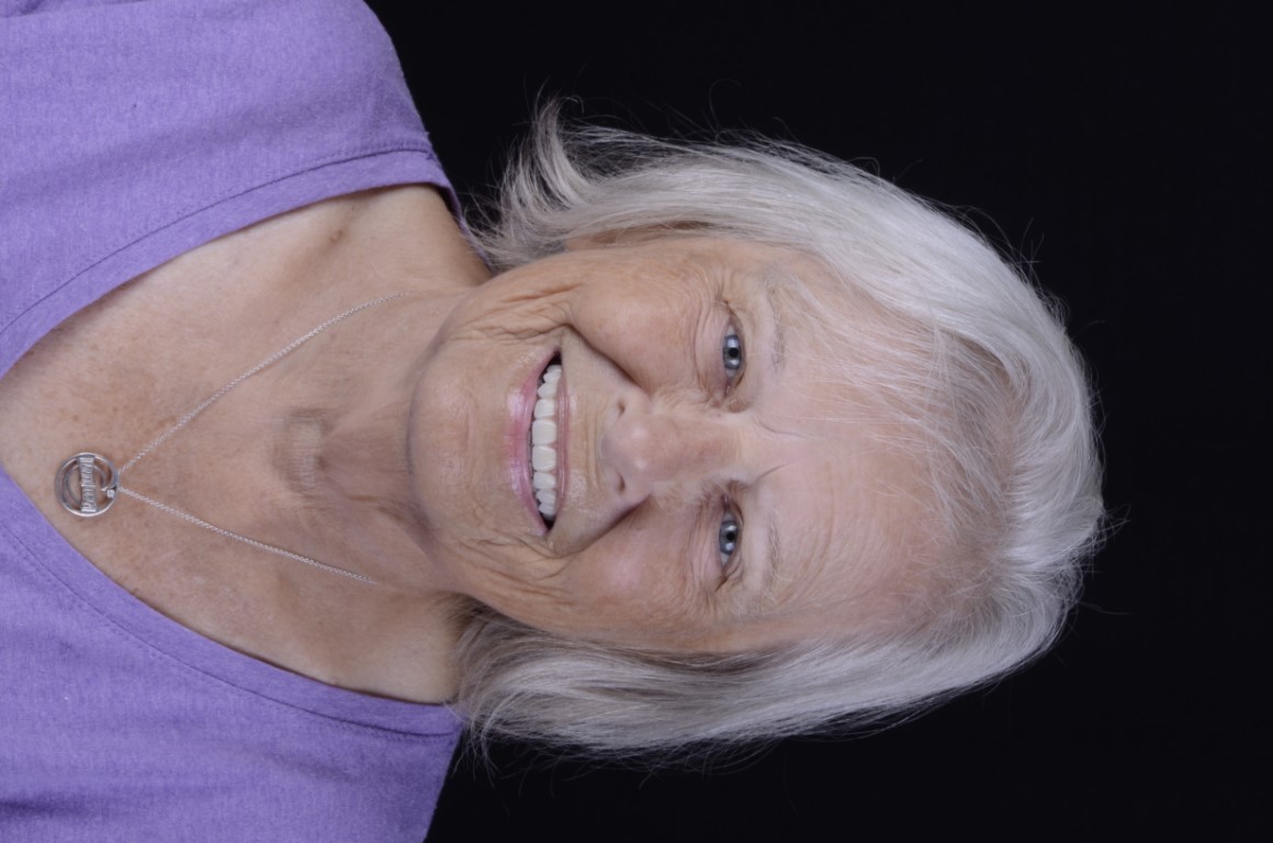 Patient Beautiful Smiles Image