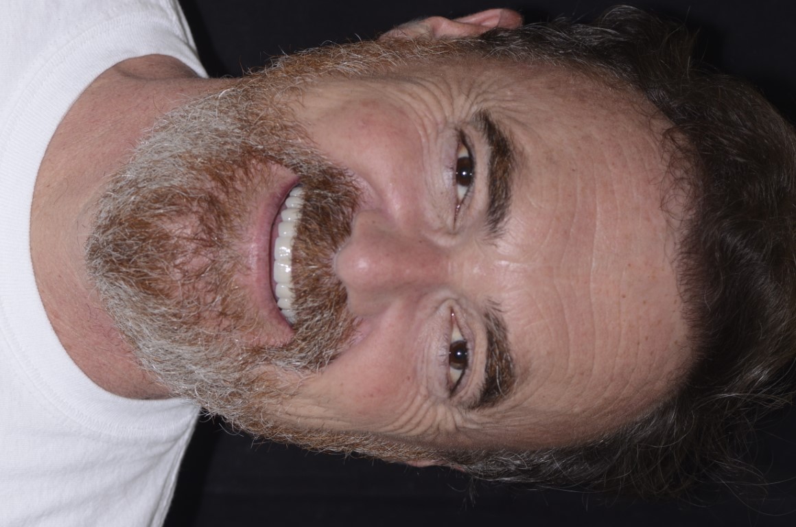 Patient Beautiful Smiles Image