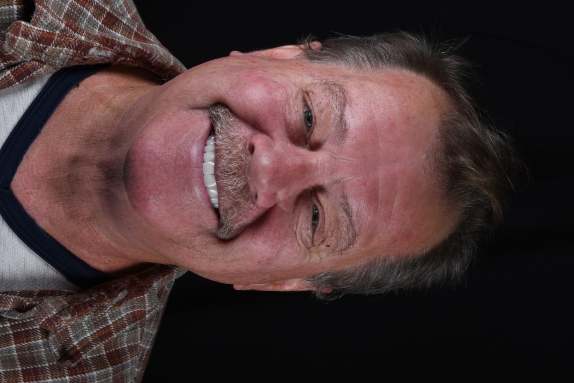 Patient Beautiful Smiles Image