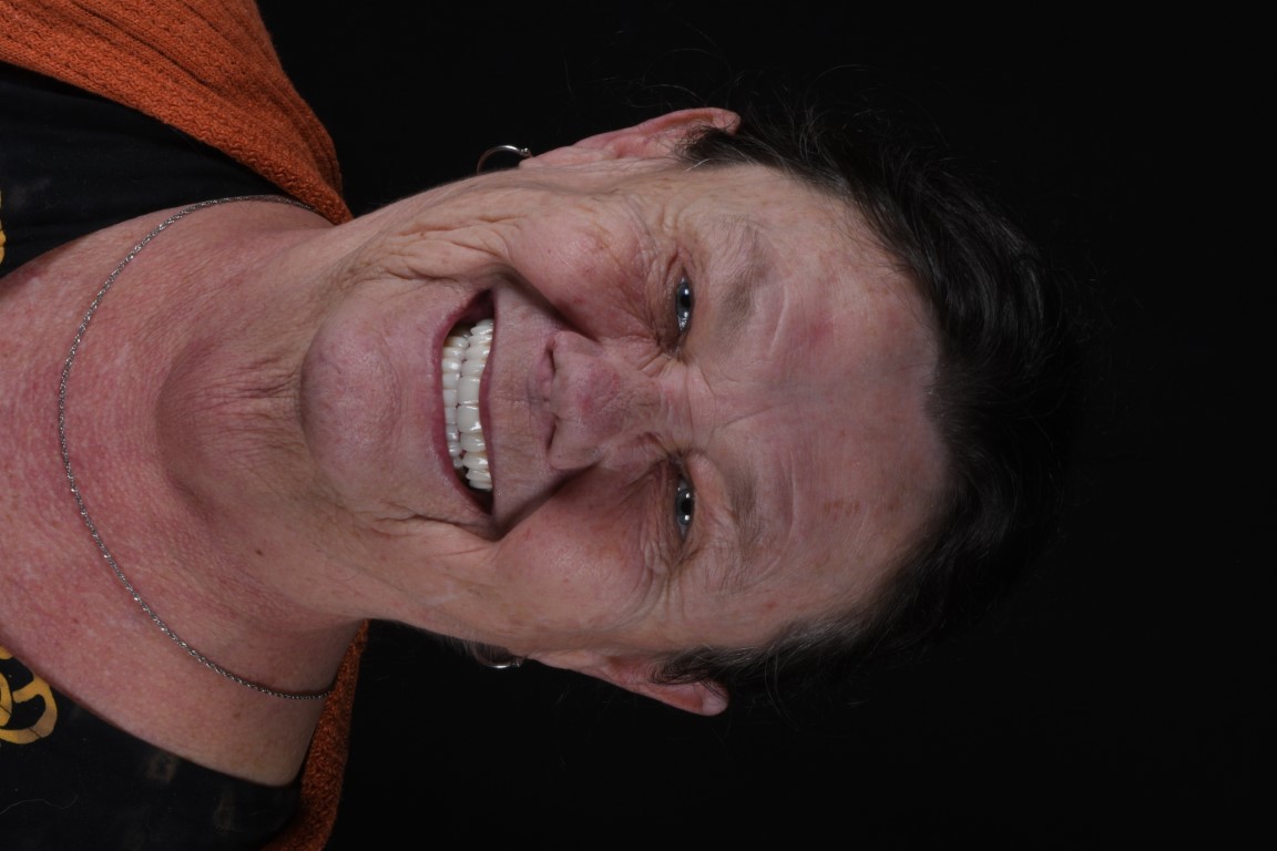 Patient Beautiful Smiles Image