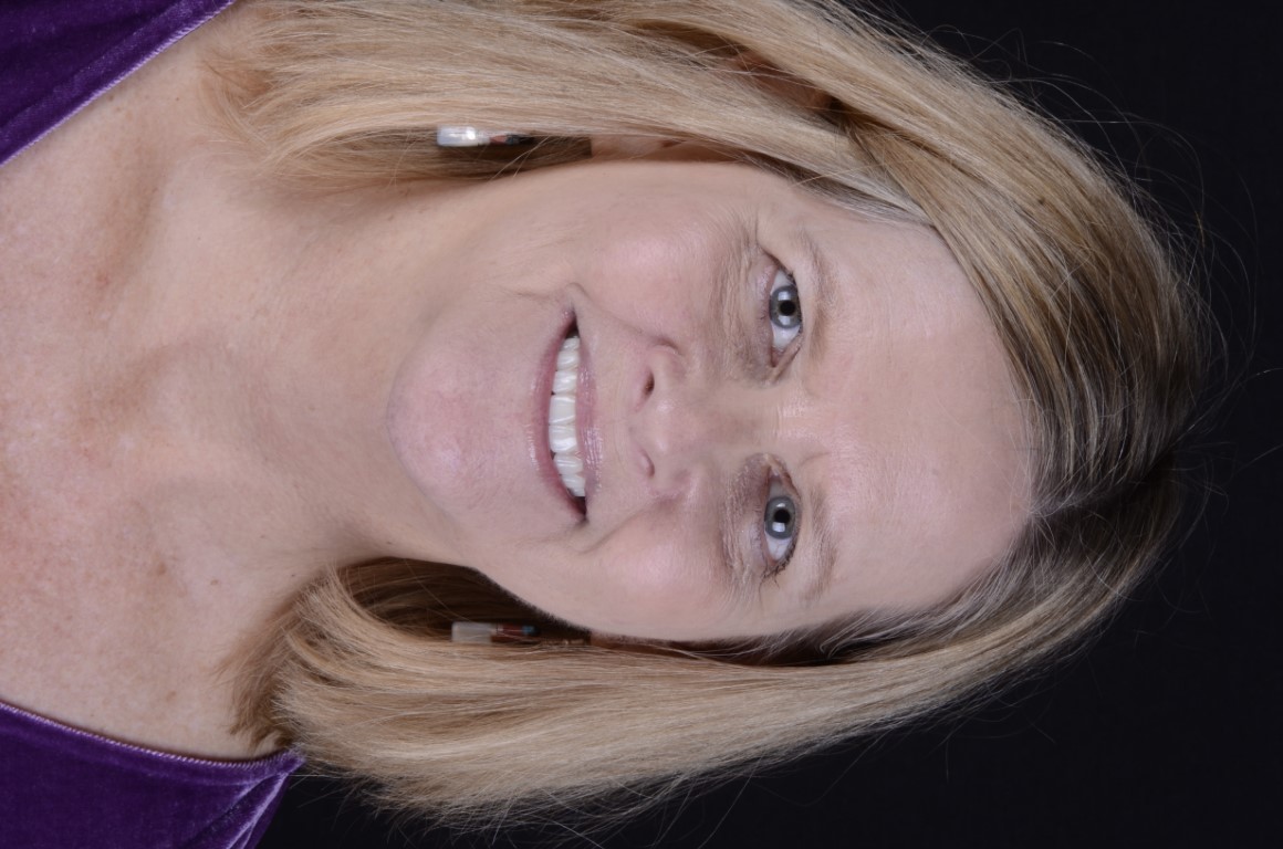 Patient Beautiful Smiles Image