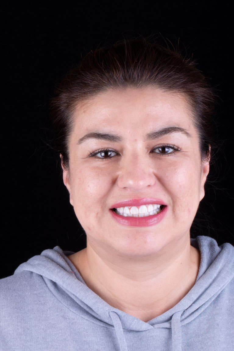 Patient Beautiful Smiles Image