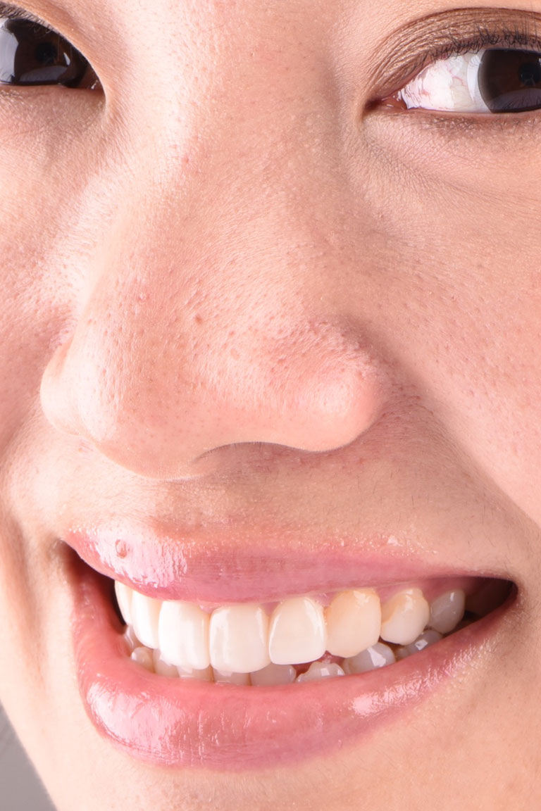 Patient Beautiful Smiles Image