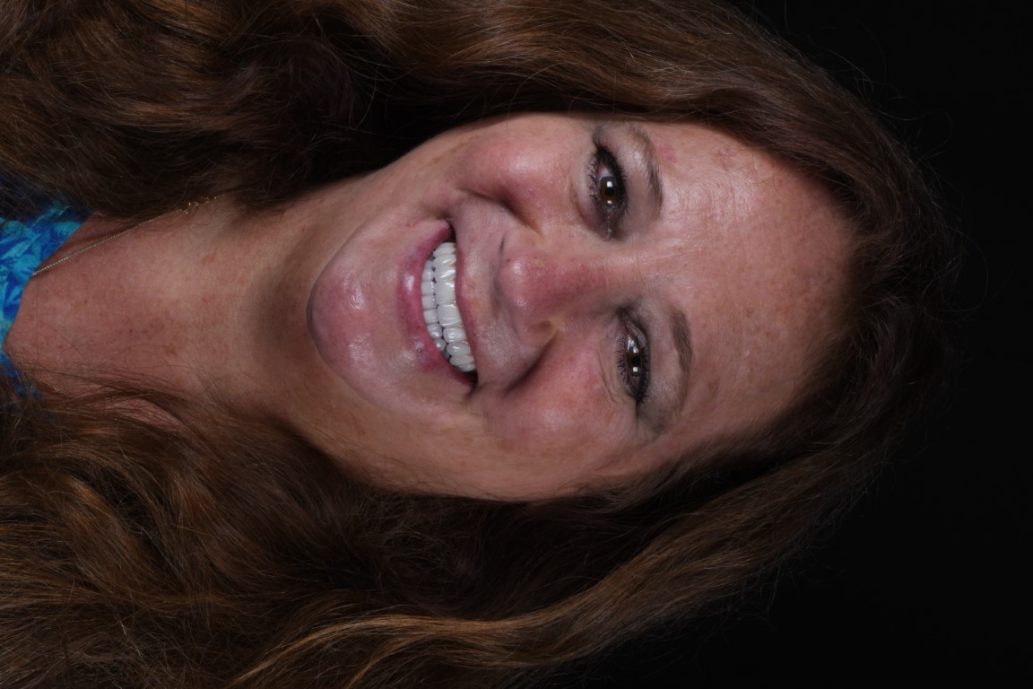 Patient Beautiful Smiles Image